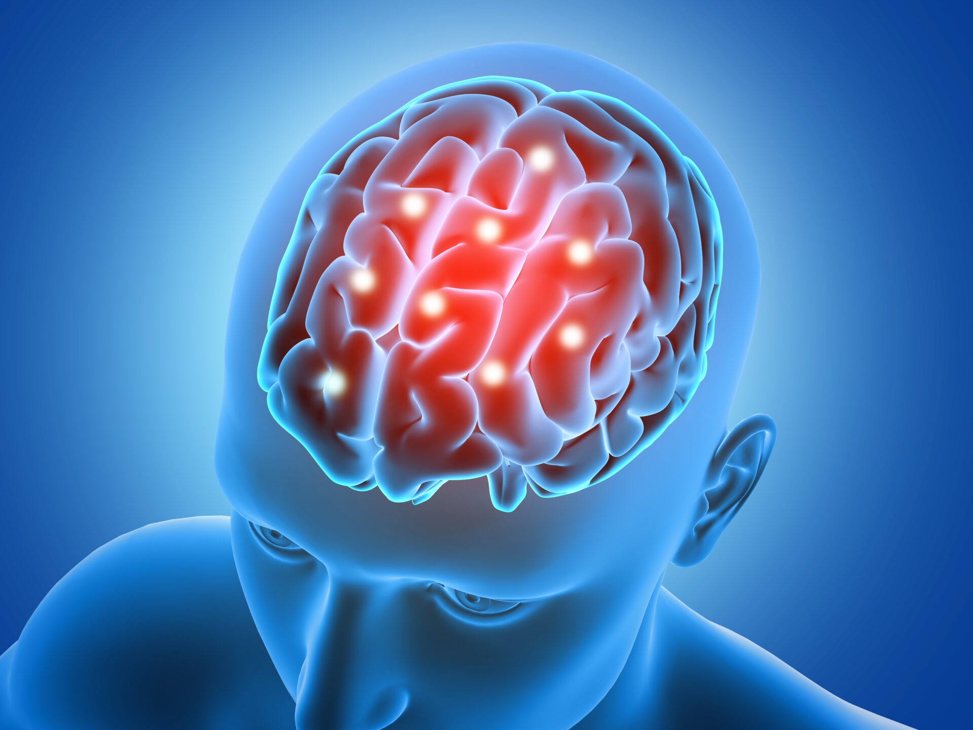 traumatic brain injury